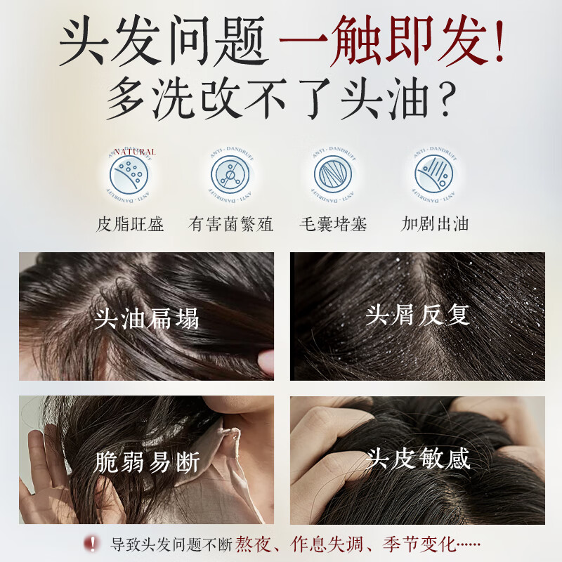 UIJO oil-controlling fluffy shampoo, anti-dandruff, anti-itching, long-lasting fragrance, supple and smooth men's and women's shampoo, No. 1 on the gold list