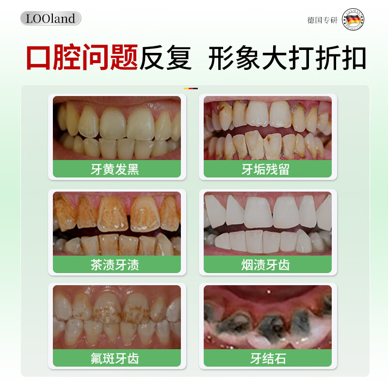 LD German imported whitening toothpaste removes yellowing, removes tooth stains, removes tobacco stains, bad breath and tartar. Top ten well-known brands. No. 1 on the gold list.