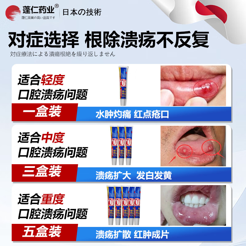 Pengren Pharmaceutical Oral Ulcer Repair Gel is a special medicine for oral ulcers. Children with sores and inflammation of the mouth and tongue can wear Oral Ulcer Patch. Oral Ulcer Powder can be used. Watermelon Cream Oral Ulcer Spray Yidianling