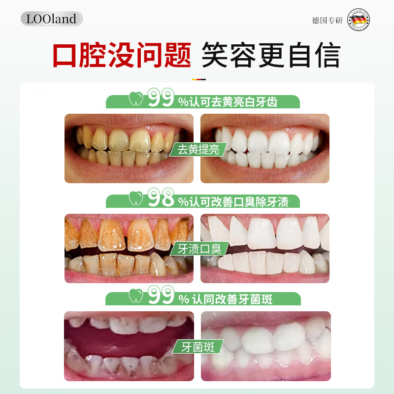 LD German imported whitening toothpaste removes yellowing, removes tooth stains, removes tobacco stains, bad breath and tartar. Top ten well-known brands. No. 1 on the gold list.