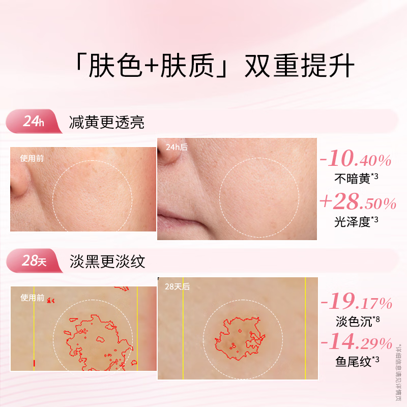 Dr. Ling Whitening Water Emulsion Set Essence Cream Constant Whitening Moisturizing Anti-Wrinkle Firming Hydrating Skin Care Products Freckles Valentine's Day Gift