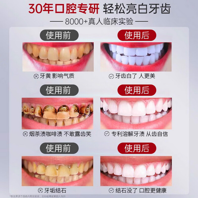 Yinqian White Tea Fragrance Fresh Niacinamide Toothpaste 150g