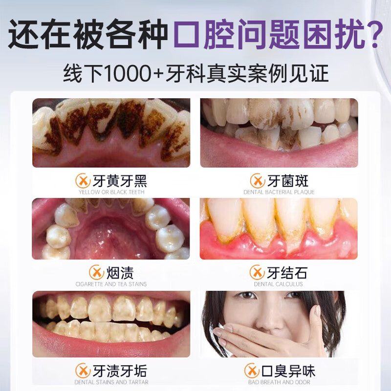 SOVIP Germany's dental calculus cleaning artifact removes bad breath, removes yellow tooth stains, removes tobacco stains, and is the first in the gold list for non-toothpaste adults