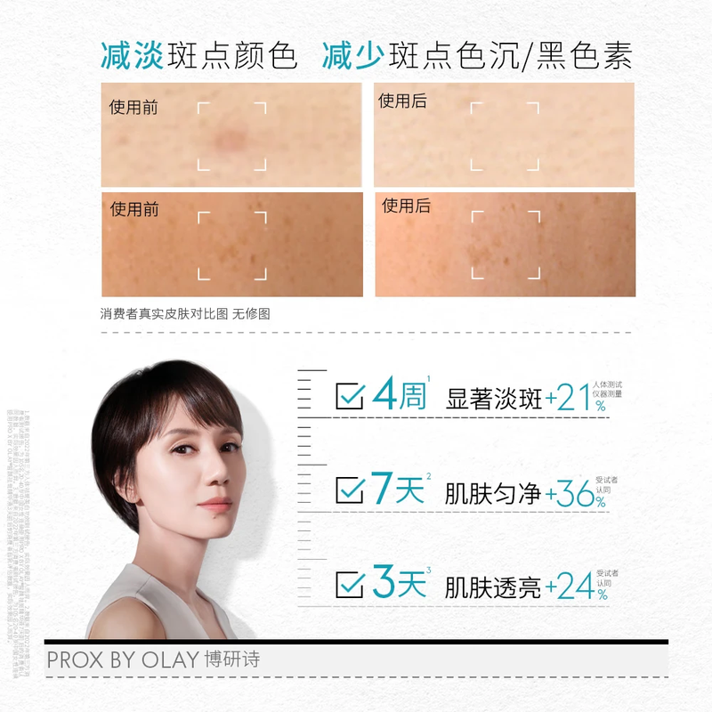 Olay (OLAY) Spot Whitening Bottle Facial Essence 7ml Whitening, Spots and Acne Marks Skin Care Product Buy-back Coupon