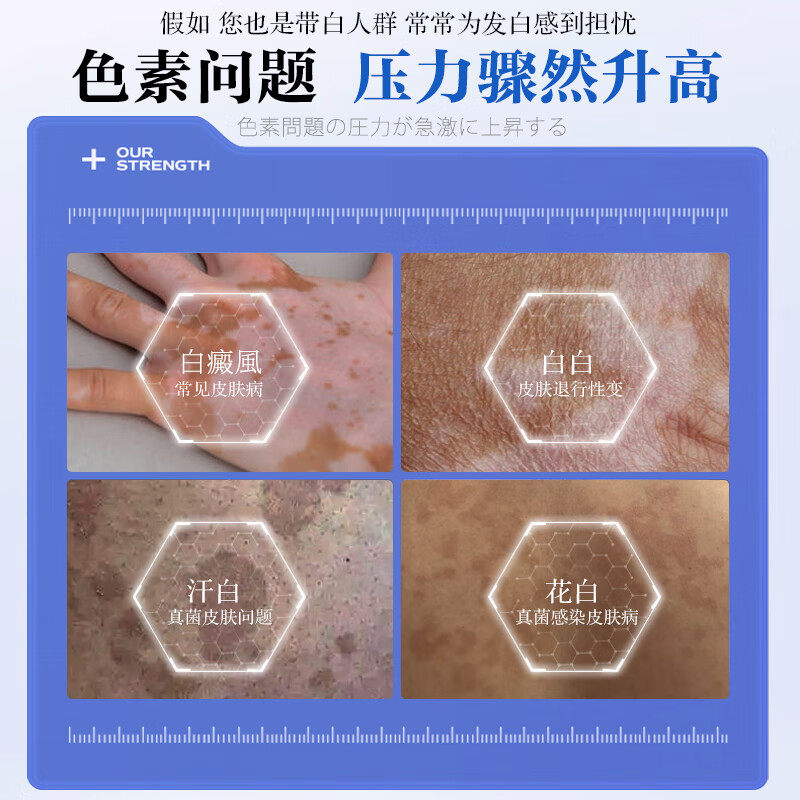 Taozhiyaoyao Vitiligo Concealer Liquid Covers White Spots Long-lasting Hand and Face Pen Cream Skin Color Concealer Artifact Waterproof and Not Easy to Fade