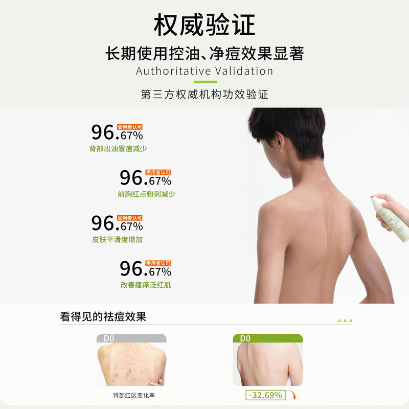 Little Lord's Diary Youth Oil Control, Acne, Beauty and Back Moisture Spray, Front Chest and Back Acne Soothing and Hydrating Puberty*2