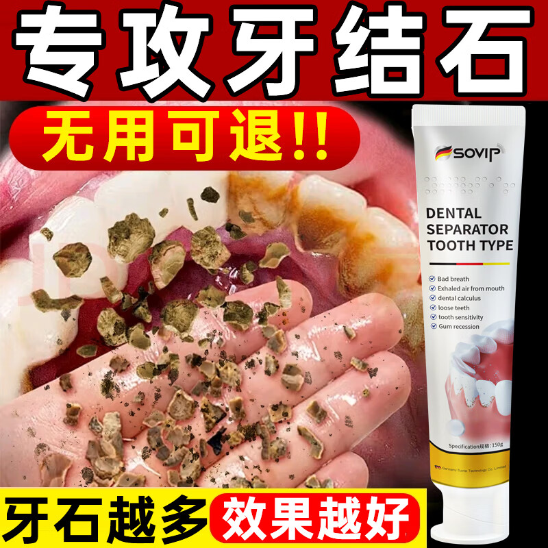 SOVIP Germany's dental calculus cleaning artifact removes bad breath, removes yellow tooth stains, removes tobacco stains, and is the first in the gold list for non-toothpaste adults