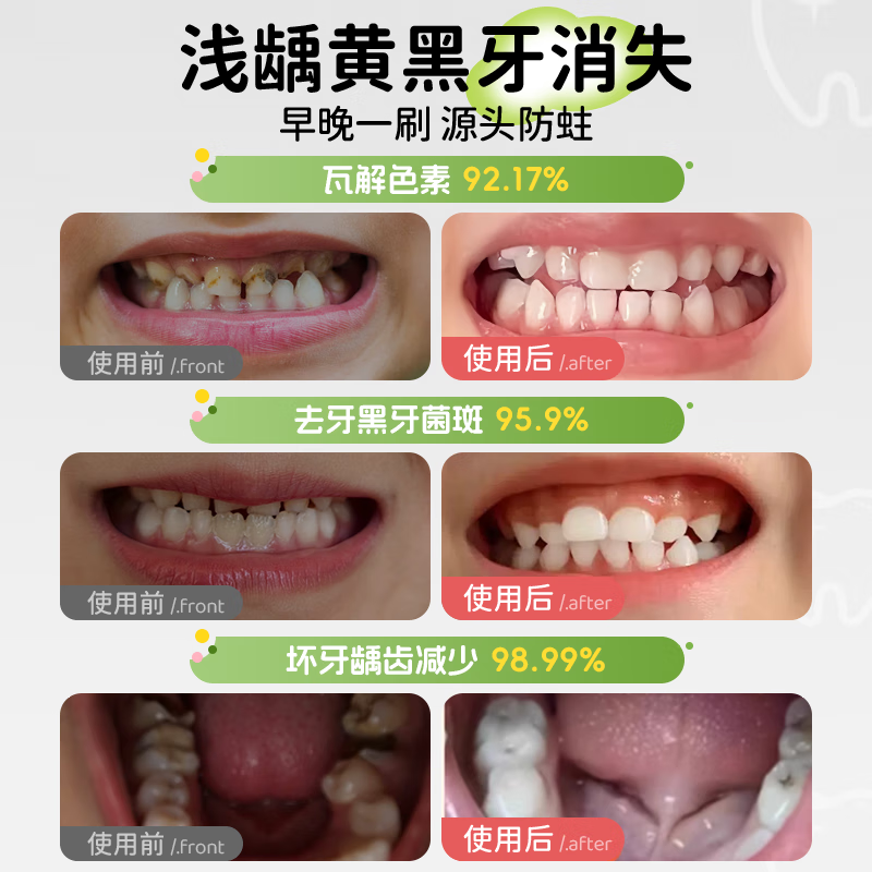 Yinyan Forest Children's Toothpaste Ora Fluoride 6-12 years old fluoride-containing tooth replacement period special 3-6 anti-moth green flavor press large capacity