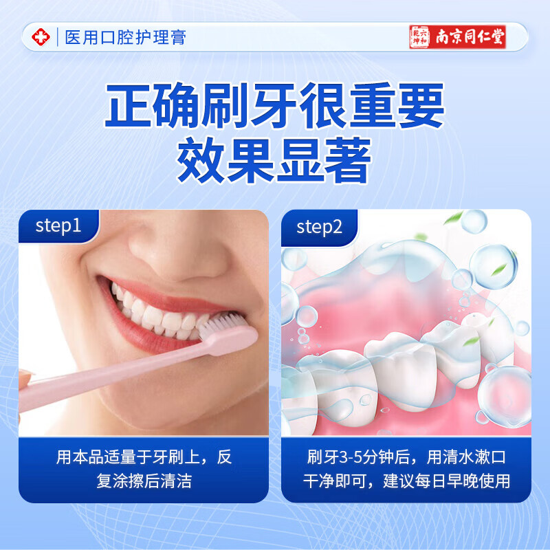 Nanjing Tongrentang dental desensitization cream for bleeding gums, receding gums, sensitivity, soreness, pain, loosening, oral care desensitization cream 2 boxes, bleeding gums, redness, swelling and soreness