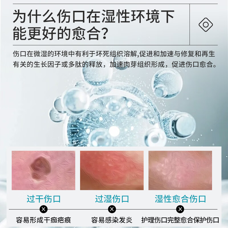 Corfu medical sterile hydrocolloid dressing 5cm*5 pieces artificial skin acne patch wet healing wound band-aid