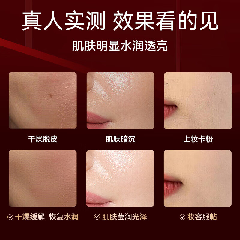 OES Oxygen Injection Instrument Hydration Instrument Humidification Artifact Atomizer Sprayer Water Light Instrument Beauty Instrument Hydrating Whitening Portable Household Facial Steamer Facial Handheld Gift for Girls Luxury Model 4 Times Penetration + Efficient Absorption + Water Light Technology + Essence Gift Pack White