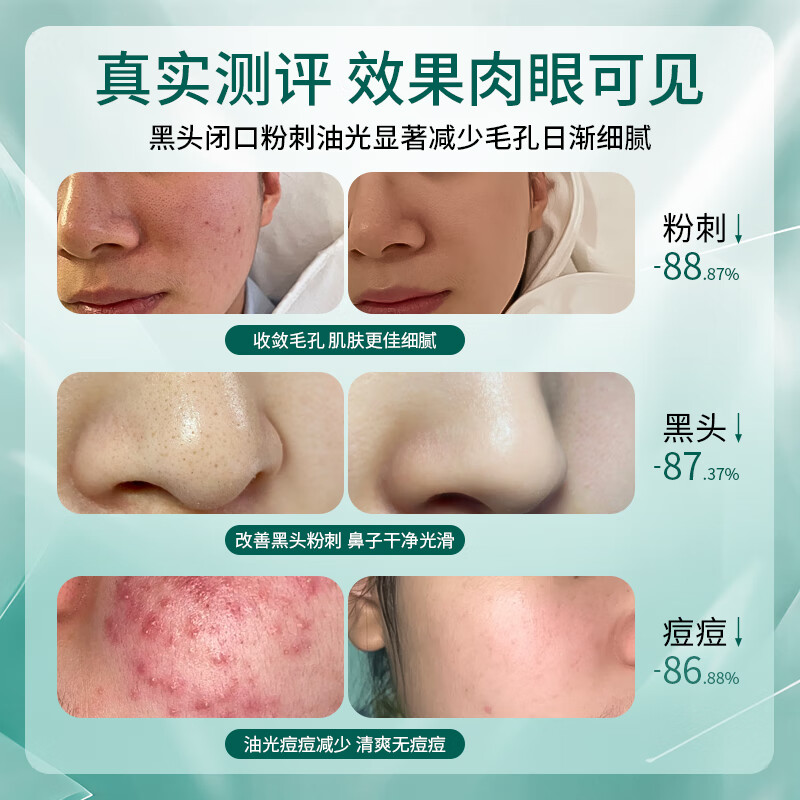 BEAUTY NOTES Centella asiatica lotion set youth skin care products 12-18 years old men and women New Year gift + facial cleanser 500g 1 bottle