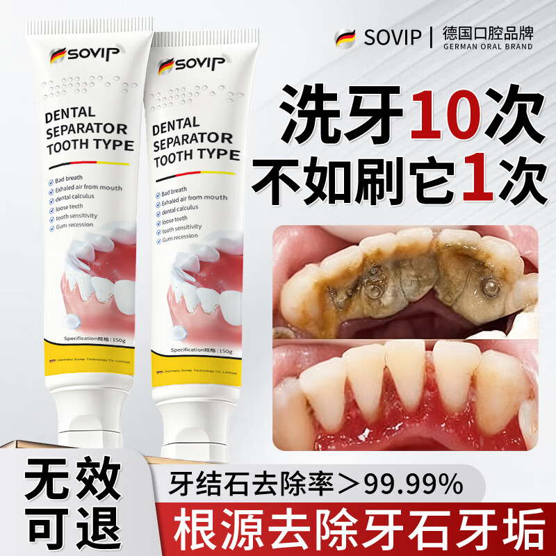 SOVIP Germany's dental calculus cleaning artifact removes bad breath, removes yellow tooth stains, removes tobacco stains, and is the first in the gold list for non-toothpaste adults