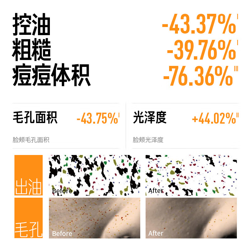 Lifelong Research Wuhuan Emulsion 100g + Wuhuan Water 100ml + Wuhuan 3.0-30ml Oily Skin Water Emulsion Set Oil Control Essence and Acne Removal