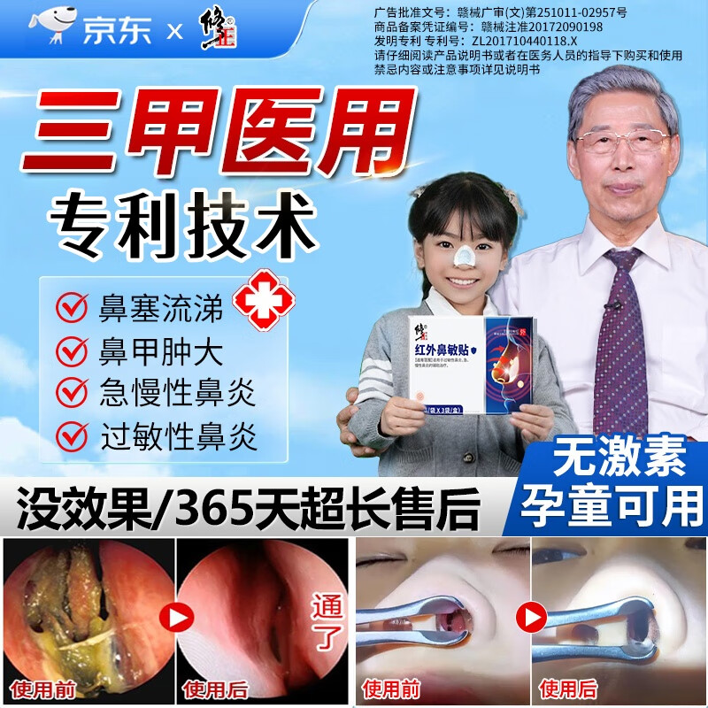 Correction of infrared nasal patches for allergic rhinitis and sinusitis, nasal congestion, runny nose, and nosebleeds 2 patches/bag x 3 bags/box xmm3