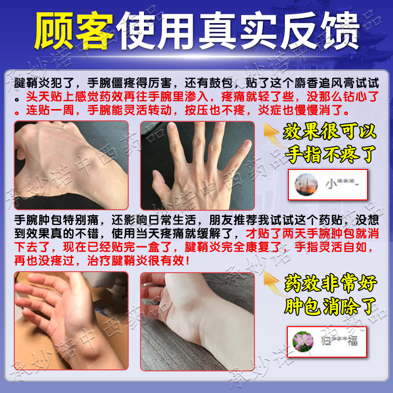 Jinshou Musk Zhuifeng Ointment 7cm*10cm*10 patches 1 box tenosynovitis 100% extra long-lasting plaster finger thumb wrist joint swelling pain stiffness rheumatoid arthritis bone trauma over-the-counter medicine soreness and stiffness numbness