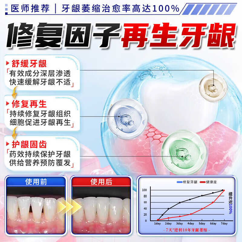 Sensodyne Repair Gum I Recession Anti-allergic Toothpaste Gum Protector Fix Teeth Reduction Gum I Recession Repair Regenerate Root Exposed Desensitization Special Effect 5 Boxes Cured No Longer Error Buy 3 Get 2 Free