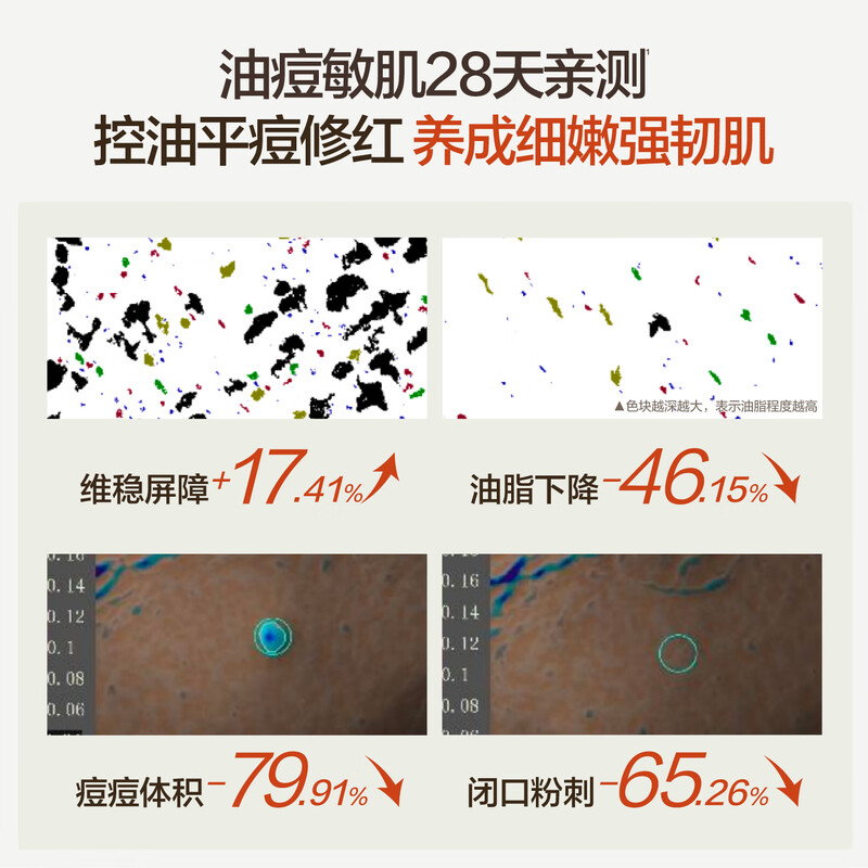 HBN Oil Control Kit Moisturizing Makeup Essence Water Wet Compress to Remove Acne and Soothe Fine Pores New Year's Valentine's Day Gift