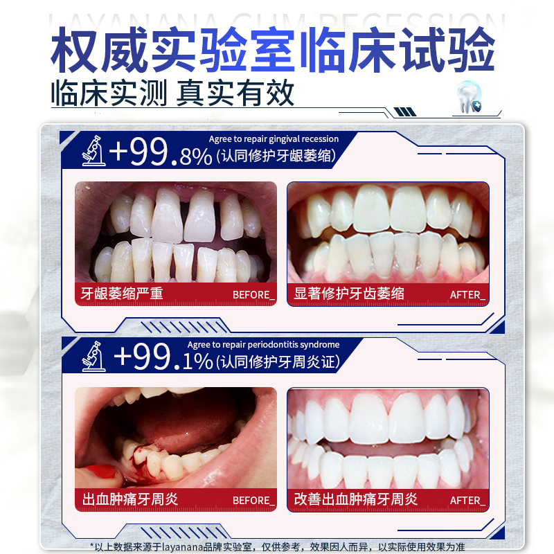 Layanana gum recession l special heavy repair regeneration silicon toothpaste gum protection l bad breath yellow tooth calculus tooth stains three boxes