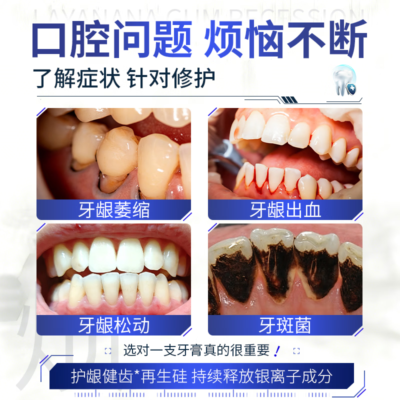 Layanana gum recession l special heavy repair regeneration silicon toothpaste gum protection l bad breath yellow tooth calculus tooth stains three boxes