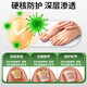 Yunnan Materia Medica Special Effect Chinese Herbal Antibacterial Liquid for Onychomycosis, Thickening, Yellowing and Empty, Anti-Analysis Water, Special Effect Kit for Onychomycosis