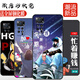 Xinweile Redmi Note11Pro Case de teléfonos móviles Soft Xiaomi Redmi Note11Pro Shell Redmi Note11EP Mengmeng Pickup (enfoque en la película templada combinada de la tienda + anillo + cordón) Redmi nota11epro Snapdragon 695 Versión