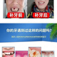 奇力康补牙齿神器材料自己在家补牙自粘补牙神器补牙材料临时补牙缝 967倍效【补15颗牙】爆丨款坚固不掉