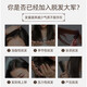 Yaopin Official L Store I Flagship Anti-Destrictive Hair Growt Shampoo Пушистый шампунь шампунь для волос с твердым шампунем для волос Мужчины и женщины, анти-дерантурные 300 мл*1 бутылки [предполагаемая периодическая установка]