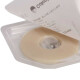 Kangebao Brava Plastilizado Patch Patch Patch 12030/12042 Accesorios de atención de anillo de ostomio de fugas 12030 [5 a granel]