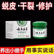 Yunnan Materia Medica Hand and Foot Peeling Antibacterial Cream Seasonal Hand Peeling Finger Palms Sloughing, Cracking, Cracking, Skin Blistering Fungal Infection Hand and Foot Peeling Cream 20g One bottle sent 1 bottle/box