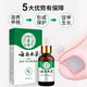 Yunnan Materia Medica Special Effect Chinese Herbal Antibacterial Liquid for Onychomycosis, Thickening, Yellowing and Empty, Anti-Analysis Water, Special Effect Kit for Onychomycosis