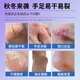 Shizhongtang Cracked Hand Cream 50g Vaseline Cracked Heels, Hands and Feet Cream Anti-Crack Official Crack Cream Chapped Cream