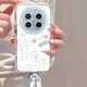 Jiang Ming eignet sich für Huawei Mate70pro Mobiltelefon Hülle HuaaweMeimate70pro+ Schutzhülle Lens Vollkuppen-Airbag Anti-Fall-Fall transparent Soft Shell Niedliche Cartoon-Schutzhülle mit Lanyard