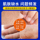 KOOGIS Japanese Ding Ding Cracked Cream Heel Anti-Dry Cracked Cracked Cracked Cracked Cracked Cracked Cracked Cracked Cracked Cracked Cracked Hands and Foot Moisturizer