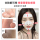 OHBT blackhead removal nose patch 10 sets of 20 pieces blackhead export liquid cleaning tool cleaning acne shrinking pores skin care products