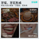 好易康溶菌酶牙膏 改善牙结石牙垢牙菌斑改善牙黄清新口气套装3支共360g
