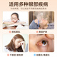 执鼎慧明干眼症雾化仪眼部蒸汽热敷眼罩护眼干涩润眼蒸眼仪喷雾熏蒸机仪器 【大腔体+小腔体眼罩款】两个眼罩搭配效果好