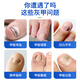 To correct onychomycosis, Chinese medicine can be used to cure nail fungal infection. New nail antibacterial solution 60ml for removing and destroying the nail.