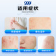 999 Sanjiu Dermatitis Ping Compound Dexamethasone Acetate Cream 30g: 22.5mg 30g/tube Neurodermatitis Contact dermatitis Seborrheic dermatitis Chronic eczema Skin itching