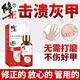 To correct onychomycosis, Chinese medicine can be used to cure nail fungal infection. New nail antibacterial solution 60ml for removing and destroying the nail.