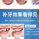 奇力康补牙齿神器材料自己在家补牙自粘补牙神器补牙材料临时补牙缝 967倍效【补15颗牙】爆丨款坚固不掉