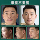 Nanjing Tongrentang Desmontaje de acné Desmontaje de pasta de acné y acné Scarlet Scarlet Boys Boys High School y alumnos femeninos alumnos y acné 20G