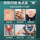Tong Ren Tang eczema itching skin itching dermatitis special scrotum moist anus inner thigh private parts anti itching 25+5ml