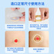 Nurse classmate stoma leakage protection ring 12035 same plastic patch ring chassis leakage protection seal elastic glue stoma care products 12030 [10 pieces/box] 2mm stoma leakage protection ring