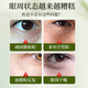 珂大生物脂肪粒眼部精华液颗粒清肌油脂粒黑眼圈眼袋眼补水保湿嫩肤凝胶霜 两盒装