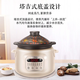 SUPOR pot set non-stick pan full set household set pan frying soup hot pot pressure cooker gas induction cooker universal frying soup steaming + hot pot + pot + stew 7-piece set