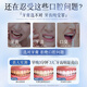 Witsmei white toothpaste bad breath remove yellowing remove tooth stains remove cigarette stains tartar protects gums fresh breath hot list
