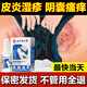 Tong Ren Tang eczema itching skin itching dermatitis special scrotum moist anus inner thigh private parts anti itching 25+5ml