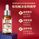 The No. 1 onychomycosis effect in Hong Kong Pharmacy, special nail fungus infection, yellowing and thickening of onychomycosis, impatiens antibacterial liquid, 2-5 onychomycosis, highly recommended, 69% people choose 3 boxes