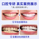 Jiafuni Pasta de dientes Limpieza de dientes blanqueamiento diente de diente fresco Hombres y mujeres Jiafuni Pasta de dientes más insignia fresca Tres paquetes*360G